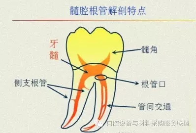 超实用的根管口的探查术