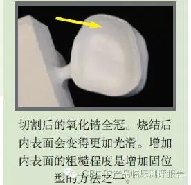 CR权威发布：如何克服氧化锆粘固时的问题