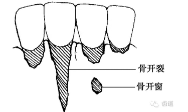 QQ图片20160825170455.png