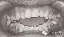 口腔医学主治医师笔试-精讲强化-龋病牙体硬组织牙髓病和根尖周