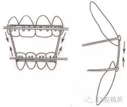 口腔医学主治医师笔试-精讲强化-龋病牙体硬组织牙髓病和根尖周