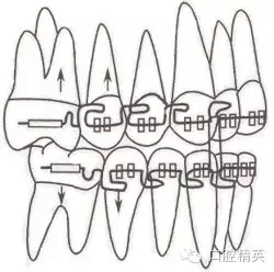 口腔医学主治医师笔试-精讲强化-龋病牙体硬组织牙髓病和根尖周