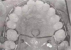 口腔医学主治医师笔试-精讲强化-龋病牙体硬组织牙髓病和根尖周