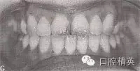口腔医学主治医师笔试-精讲强化-龋病牙体硬组织牙髓病和根尖周