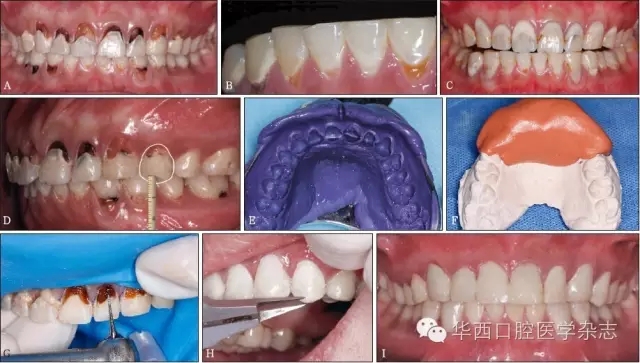 Cariostat龋易感性技术指南