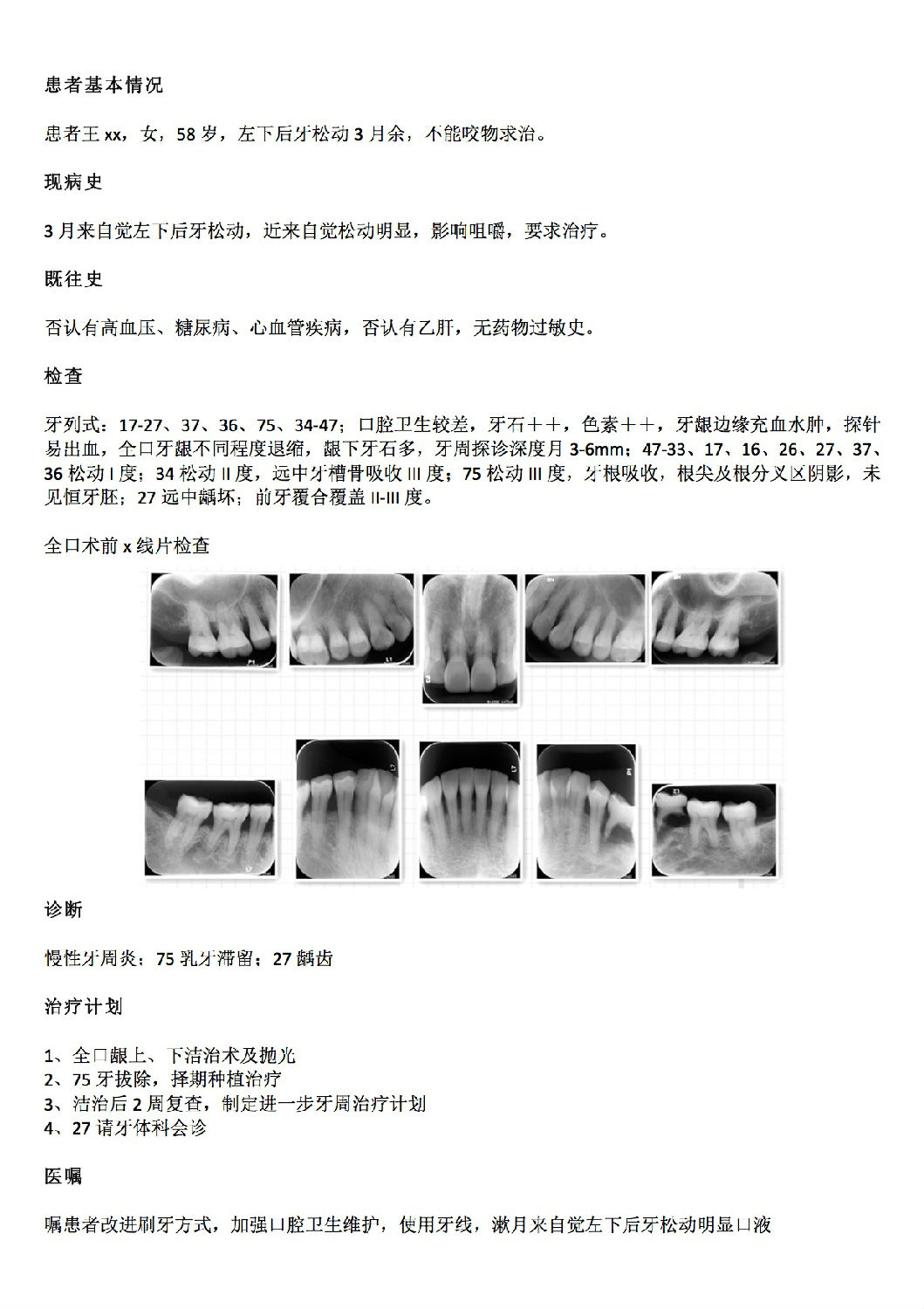 牙周膜龈手术+植骨（PAOO）记录 - 知乎