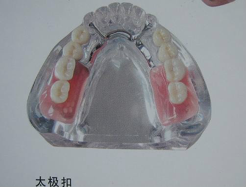 精密附件种类图谱