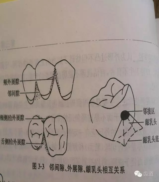 牙体缺损修复原则及要点总结