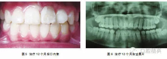 640.webp (4).jpg 640.webp (4).jpg