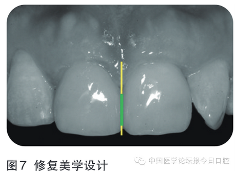 QQ图片20161111164852.png