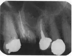 @6M9H5XZJ4`GR4W2RU`BICN.png @6M9H5XZJ4`GR4W2RU`BICN.png