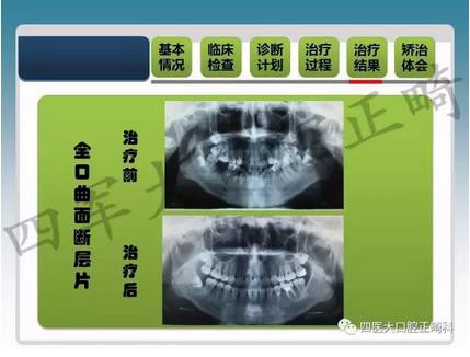 360截图20170124150313962.jpg