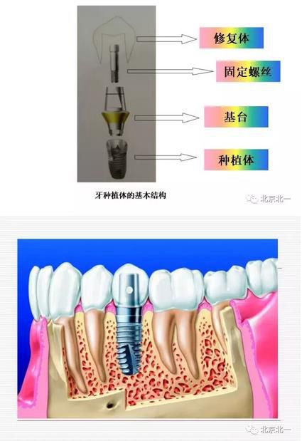 360截图20170422173323019.jpg