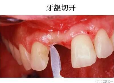 360截图20170422174616675.jpg