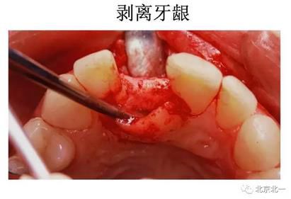 360截图20170422174630675.jpg