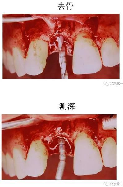 360截图20170422174719643.jpg