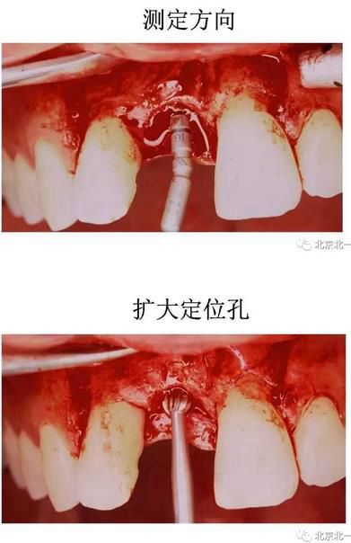 360截图20170422174733836.jpg