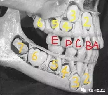 儿童牙科治疗q&a