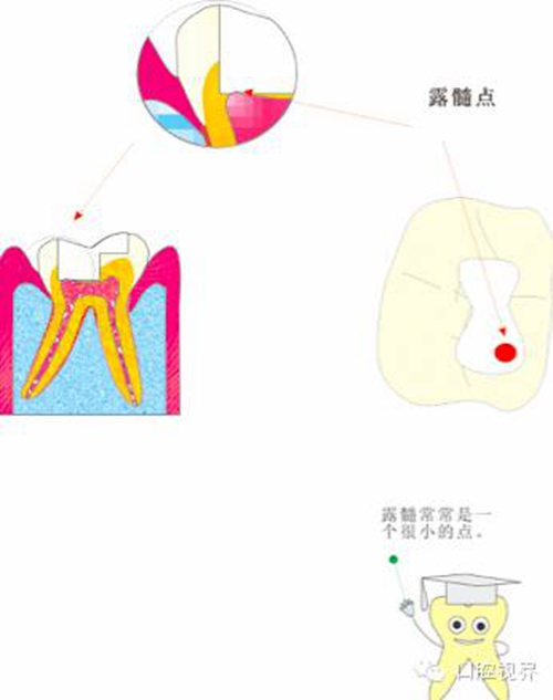 【爱牙科普知识300问】 “什么是融合牙、愈合牙和双生牙？”