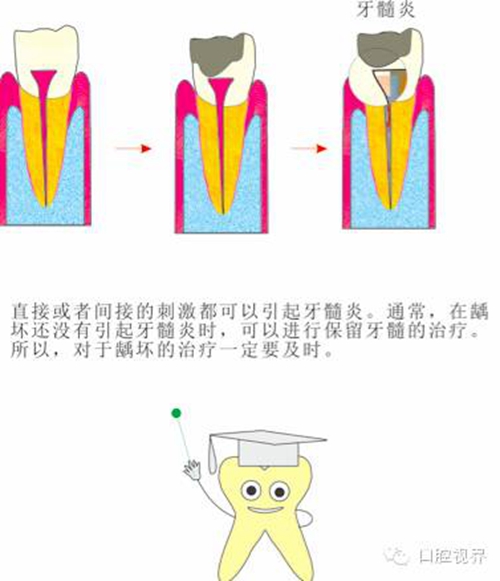 【爱牙科普知识300问】 “什么是融合牙、愈合牙和双生牙？”