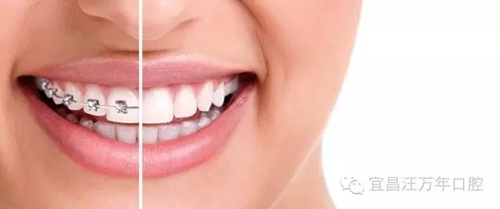 【爱牙科普】为什么牙齿排列不齐的人这么多？