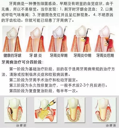 亿博电竞官网平台天津做满口种植牙好的医院 天津口腔医院排名