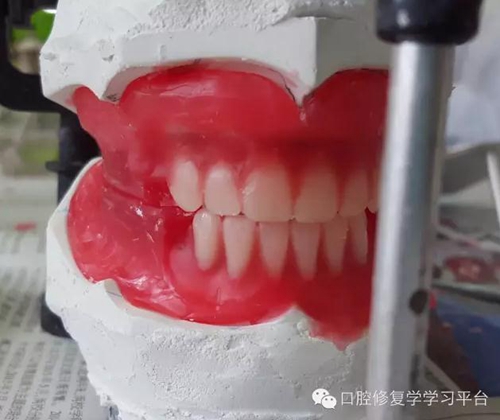 全口义齿的制作:排牙方法 科贸嘉友收录