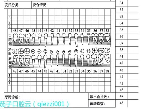 	口腔修复治疗中，常见临床接诊流程