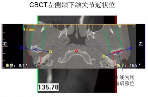 	口腔修复治疗中，常见临床接诊流程