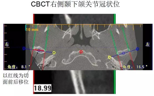 	口腔修复治疗中，常见临床接诊流程