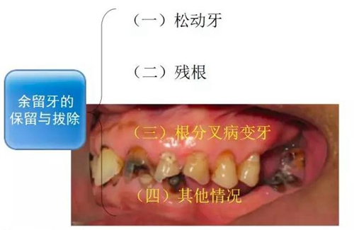 	口腔修复治疗中，常见临床接诊流程