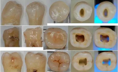 各牙齿的大概的开髓形态