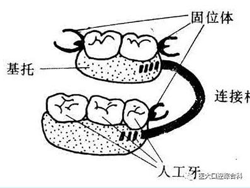 医大口腔综合科 |“镶牙”的学问——活动类 