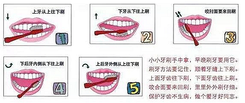 牙周病患者的外提升 梁光强