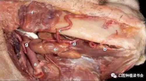 与骨增量相关的下颌区域解剖标志（1）
