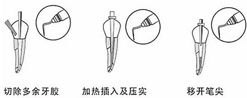 新热熔充填系统C-Fill