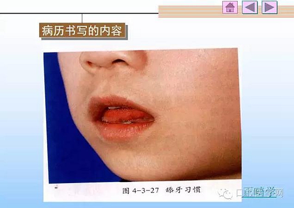 口腔正畸学病历书写  