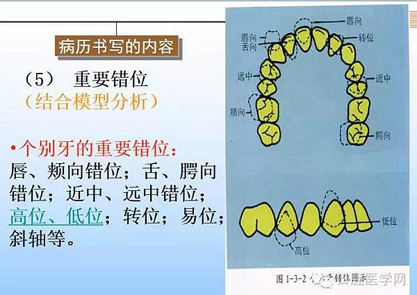 口腔正畸学病历书写  