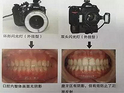 口腔摄影方法与技巧