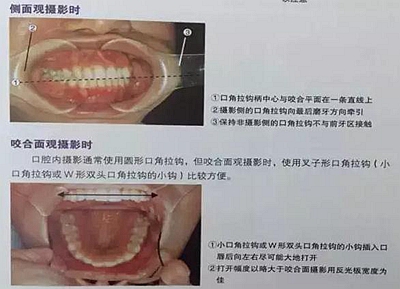 口腔摄影方法与技巧