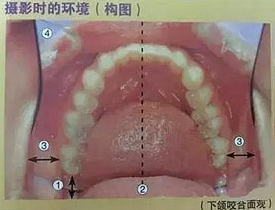 口腔摄影方法与技巧