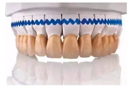一位资深牙医的总结 | 如何减轻患者镶牙后酸痛症状的措施！