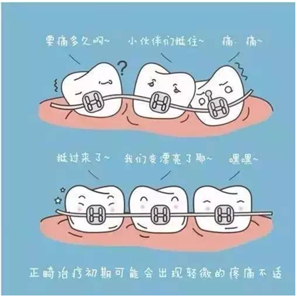 关于牙齿矫正，你想知道的都在这！