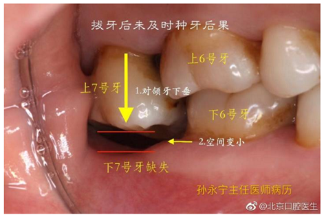 塞牙也是一种病