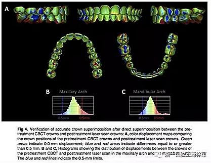 正畸文献阅读--正畸过程中牙根移动的三维监测