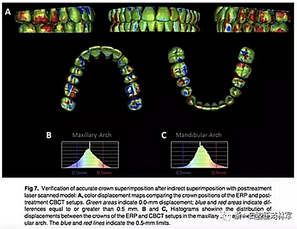 正畸文献阅读--正畸过程中牙根移动的三维监测