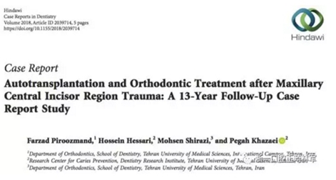 文献优秀正畸病例赏析--上颌中切牙区受伤后自体牙移植及正畸治疗13年随访病例