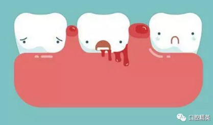 别把牙龈出血不当病！这五个口腔问题会要命