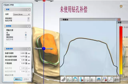 全锆牙冠裂原因分析—操作流程工艺以及患者日常使用