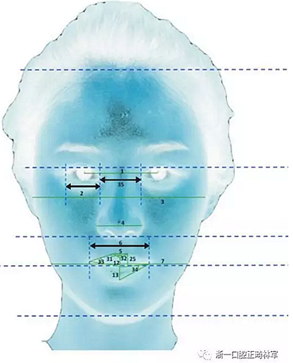 正畸文献阅读--对美貌年轻女性面部尺寸的分析